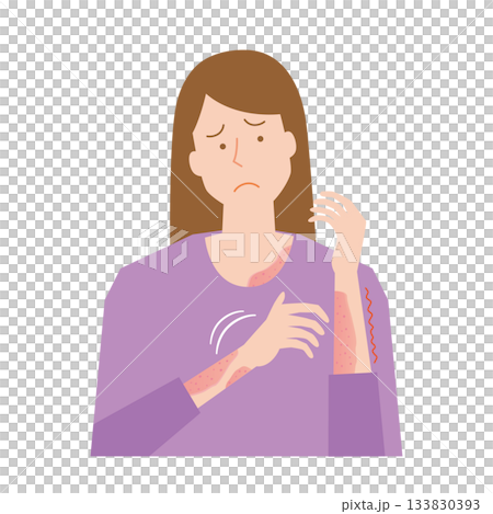 Woman suffering from itchy skin Woman suffering from itchy skin 133830393