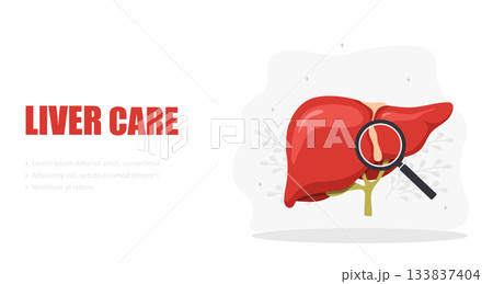 Liver care concept. Internal organ diseases. Medical flat vector illustration with organ model Liver care concept. Internal organ diseases. Medical flat vector illustration with organ model 133837404