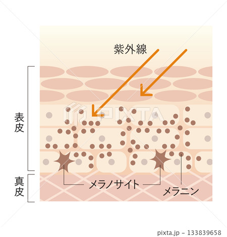 紫外線とシミの関係 紫外線とシミの関係 133839658