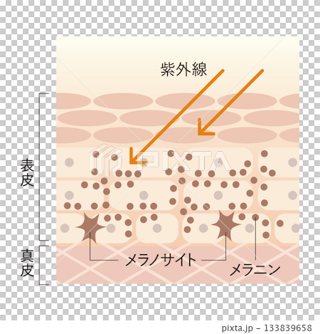 紫外線とシミの関係 紫外線とシミの関係 133839658
