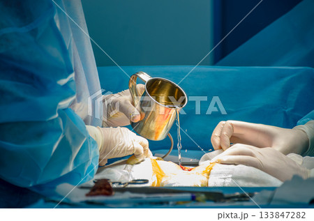 The surgeon washes the surgical field with a stainless steel mug. The surgeon washes the surgical field with a stainless steel mug. 133847282