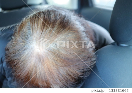 薄毛の女性 ドライブ中不意に下を向くと白髪と薄毛 133881665