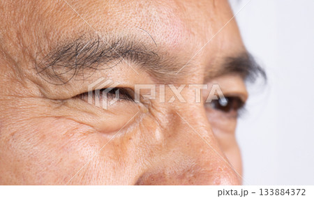 Senior man eye strain after for long stretches at digital screens. 133884372