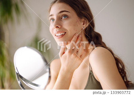 Young woman with problem skin looking into mirror. Concept of acne therapy, scars Young woman with problem skin looking into mirror. Concept of acne therapy, scars 133903772