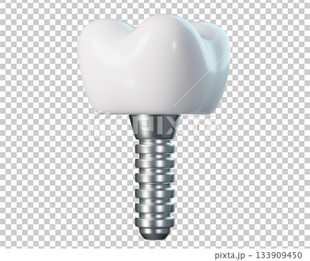 3D Dental Implant with Crown and Screw Post for Tooth Replacement. Tooth for Dental, Dentistry, Orthodontics. 3d rendering 133909450