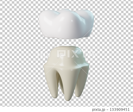 Tooth with a Detached Dental Crown. 3D Dental Implant for Dental, Dentistry, Orthodontics. 3d rendering Tooth with a Detached Dental Crown. 3D Dental Implant for Dental, Dentistry, Orthodontics. 3d rendering 133909451