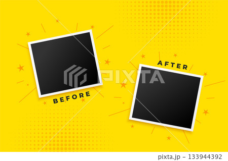 photo frame for before and after duel comparison template 133944392