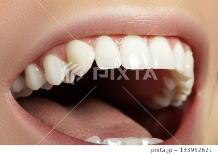Dental Beauty. Beautiful Macro with perfect White Teeth. Fashion Lips Natural Make-up. Whitening Tooth, Wellness Treatment 133952621