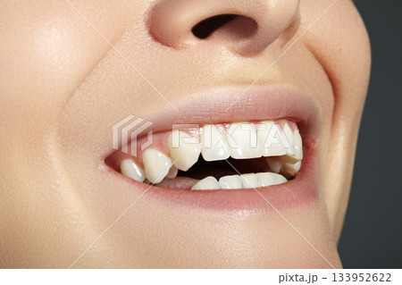 Dental Beauty. Beautiful Macro with perfect White Teeth. Fashion Lips Red Make-up. Whitening Tooth, Wellness Treatment 133952622