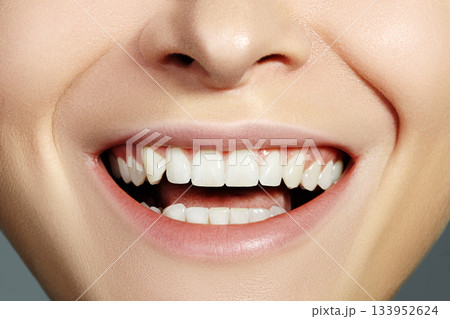 Dental Beauty. Beautiful Macro with perfect White Teeth. Whitening Tooth, Wellness Treatment 133952624