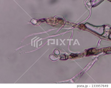 分生子が成長する様子 133957649
