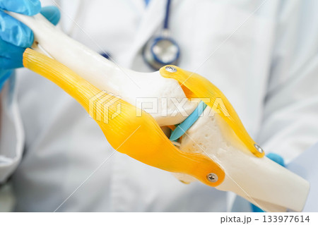 Asian doctor holding spinal nerve and bone model, Lumbar spine displaced herniated disc fragment for treatment medical in the orthopedic department. 133977614