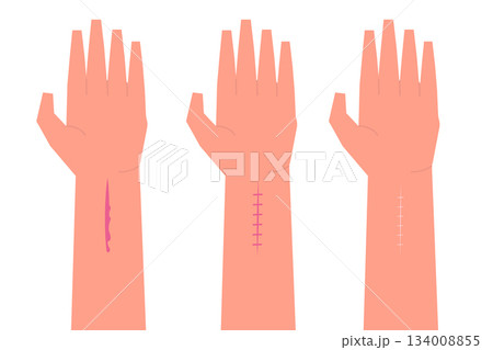 Hand cut blood, First aid treatment concept. Flat vector illustration 134008855