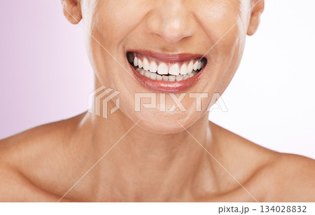 Face, smile and dental teeth of woman with veneers, smiling or tooth whitening in studio isolated on a purple background. Oral health, skincare makeup and lip cosmetics of happy female with beauty. 134028832
