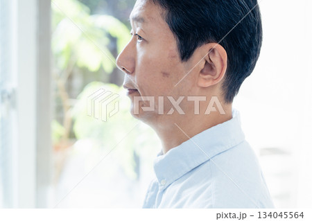 シミのある中高年男性 134045564