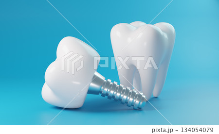 Dental Implant and Natural Tooth Model on Blue Background 134054079