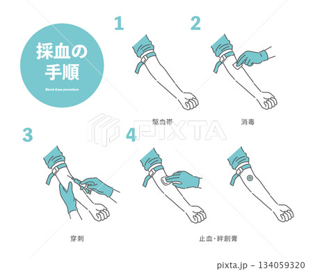 採血の手順イラスト(駆血帯・消毒・穿刺・止血) 採血の手順イラスト(駆血帯・消毒・穿刺・止血) 134059320