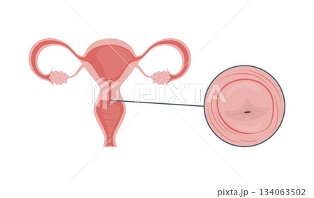 Medical illustration of the uterus and cervix 134063502