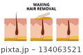 Waxing hair removal process showing before, during and after phases 134063521