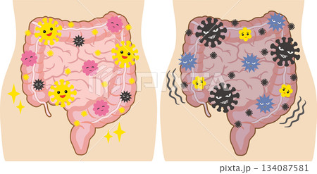 の良い腸内環境と悪い腸内環境のセット　人体付き 134087581