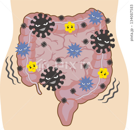 バランスの悪い腸内環境 人体付き バランスの悪い腸内環境 人体付き 134087583