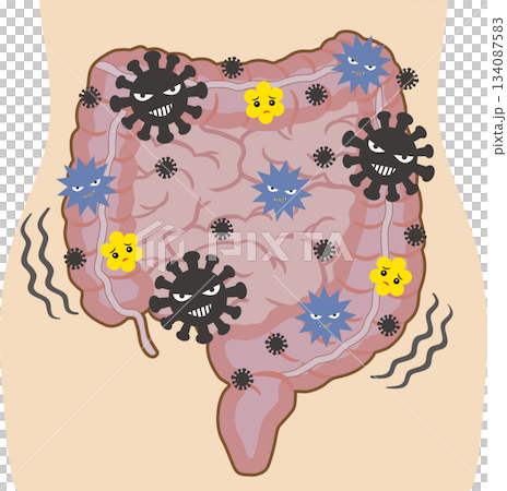 バランスの悪い腸内環境 人体付き バランスの悪い腸内環境 人体付き 134087583
