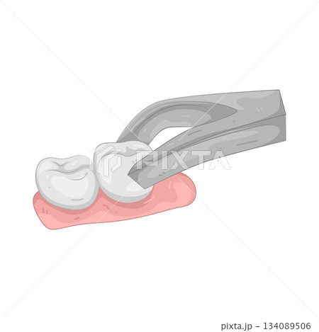 Illustration of dental extraction 134089506