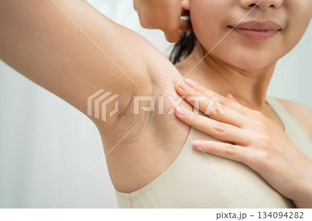 Asian woman have problem black armpit beauty skin care. Asian woman have problem black armpit beauty skin care. 134094282
