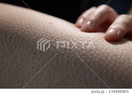 Feeling Goosebumps on Skin During a Moment of Excitement or Fear at an Indoor Location Feeling Goosebumps on Skin During a Moment of Excitement or Fear at an Indoor Location 134096963