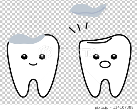 一組牙齒，有的做了金屬嵌體修復，有的牙齒填充物卻意外脫落。 134107399