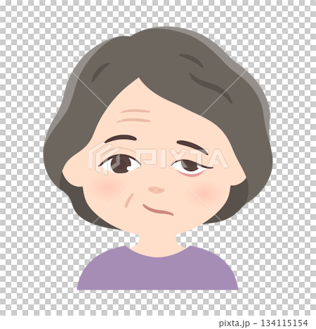 左側面癱示意圖 左側面癱示意圖 134115154