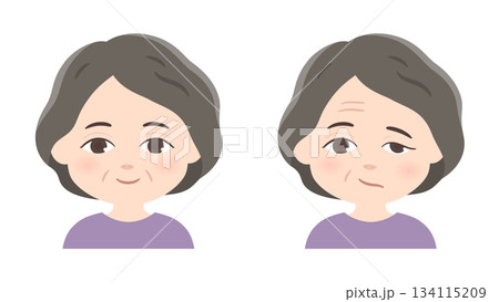 左顔面神経麻痺と健常の高齢女性のイラスト 左顔面神経麻痺と健常の高齢女性のイラスト 134115209