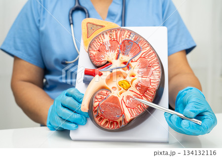 Chronic kidney disease, Asian woman with model for treatment urinary system, urology, Estimated glomerular filtration rate eGFR. Chronic kidney disease, Asian woman with model for treatment urinary system, urology, Estimated glomerular filtration rate eGFR. 134132116