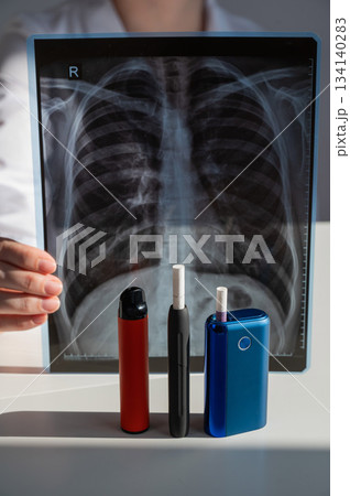 Doctor holds x-ray of lungs with e-cigarettes and vape in background.  134140283