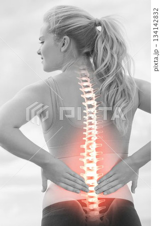Highlighted spine of woman with back pain 134142832