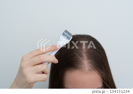Close up young woman using microneedle derma roller on scalp for stimulating new hair growth, focus on derma roller. Alopecia treatment, scalp stimulation, hair loss and baldness therapy. 134151234