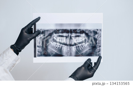 Dentist holding a dental x-ray against a white background with space for text, showing professional oral care Dentist holding a dental x-ray against a white background with space for text, showing professional oral care 134153565