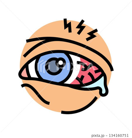 eye redness from pollen allergy color icon vector illustration 134160751