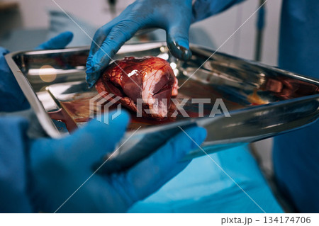 Hospital, doctor and organ transplant surgery in operating room with hands, healthcare and medical emergency. Blood, people hand and closeup of donor operation for healthy organs and surgeon at work 134174706