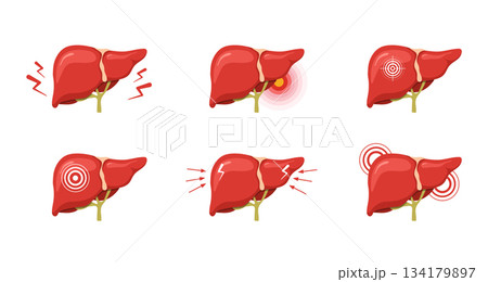 Liver pain. Medical illustration of human liver anatomy. Disease treatment and healthcare icons. Vector design 134179897