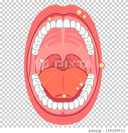 口腔炎易發部位：口腔內部、醫療護理 134184513