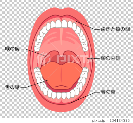 口腔炎易發部位：口腔內部、醫療護理 134184556