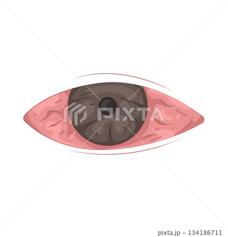 Illustration of red eye  134186711