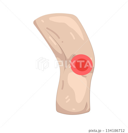 Illustration of knee pain 134186712