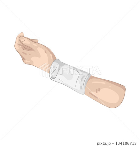 Illustration of hand injury  134186715