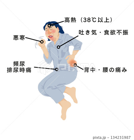 腎盂腎炎の症状を示す女性患者の医療イラスト｜高熱・悪寒・腰背部痛・排尿時痛 134231987