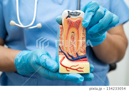 Dentist holding dental implant, artificial tooth roots into jaw, root canal of dental treatment, gum disease, teeth model for dentist. 134233054
