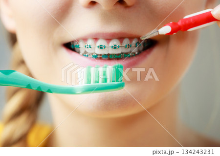 Girl with teeth braces using interdental and traditional brush 134243231