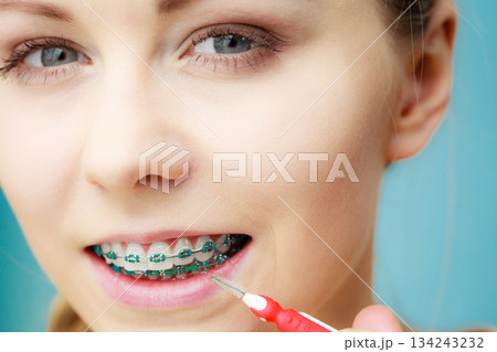 Woman with teeth braces using interdental brush 134243232