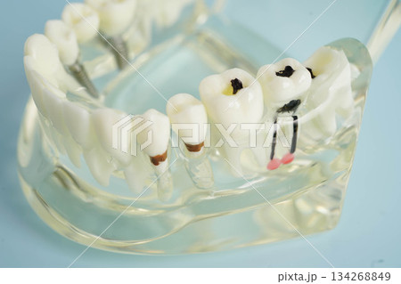 Dental teeth model on white background for learn about dentistry. 134268849